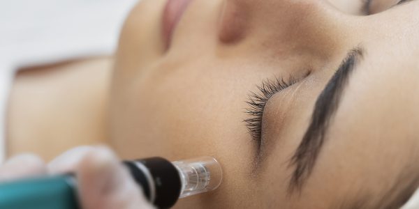 Hydrafacial Δερμοαπόξεση για Καθαρισμό & Ανάπλαση Προσώπου